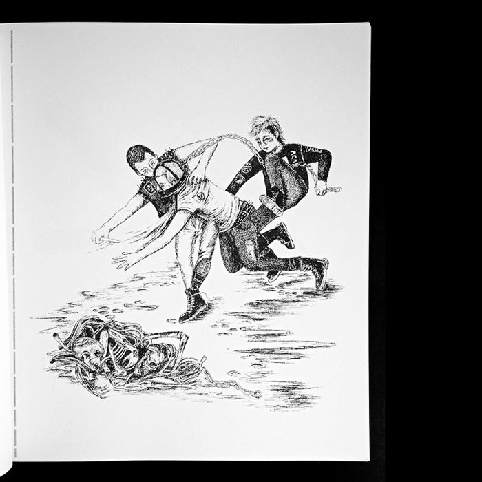 BLEFAROPTOSIS – GABRIELA FRAGA