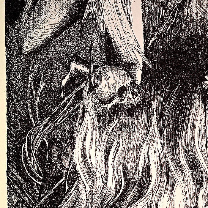 BLEFAROPTOSIS – GABRIELA FRAGA