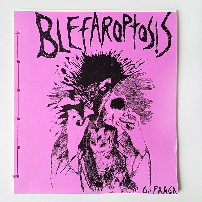 BLEFAROPTOSIS – GABRIELA FRAGA