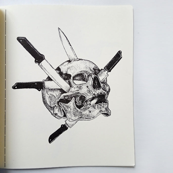 BLEFAROPTOSIS – GABRIELA FRAGA