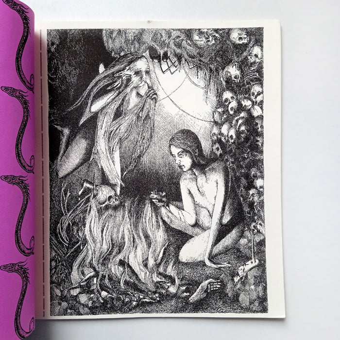 BLEFAROPTOSIS – GABRIELA FRAGA